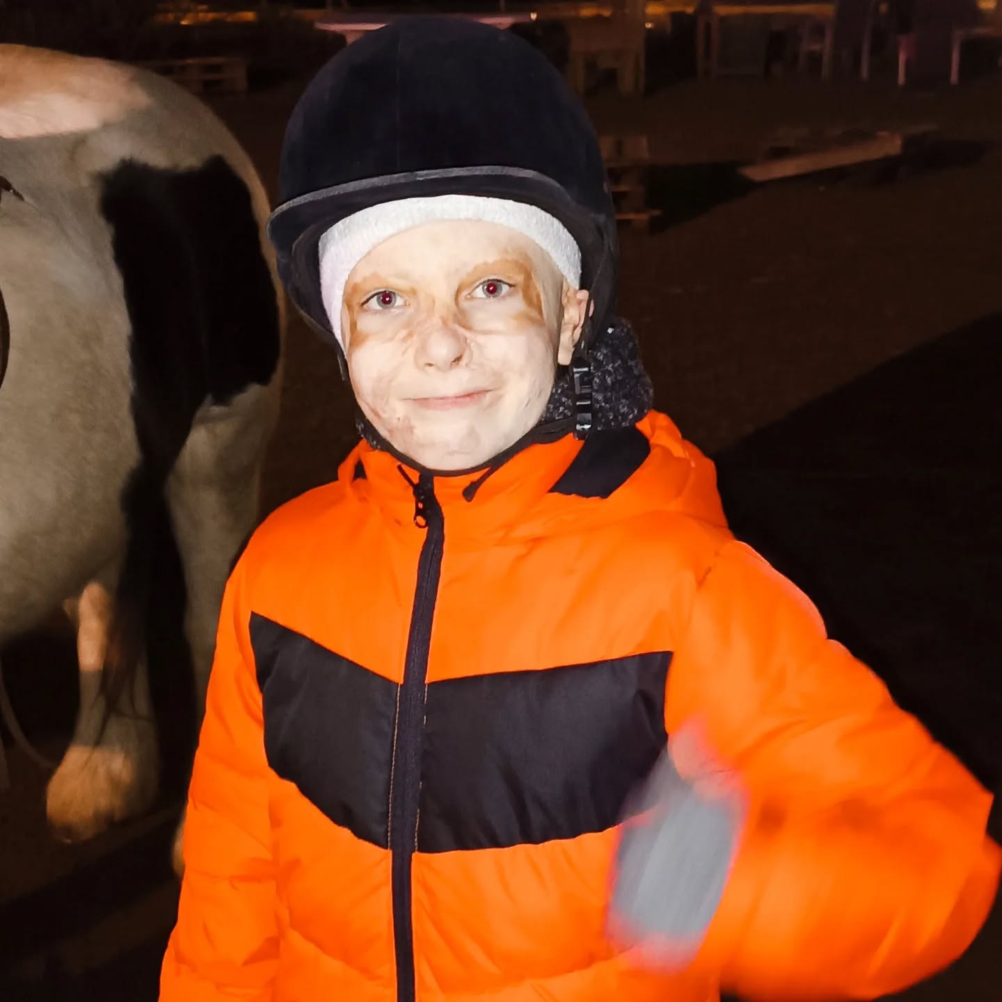 Маска останется воспоминанием. Мальчик, который чудом выжил после ракетного удара в Виннице, снова танцует